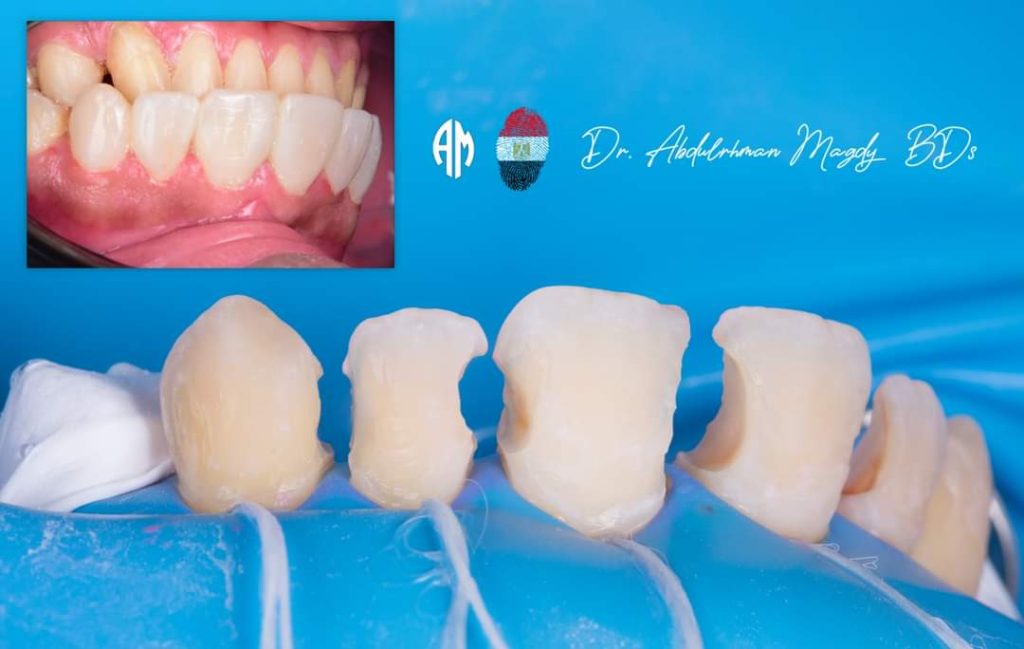 FB_IMG_1679817403837