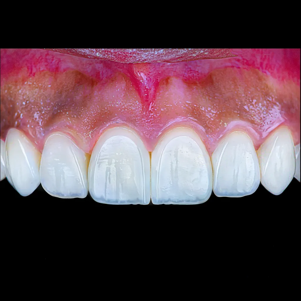 IMG_20230315_205103_712