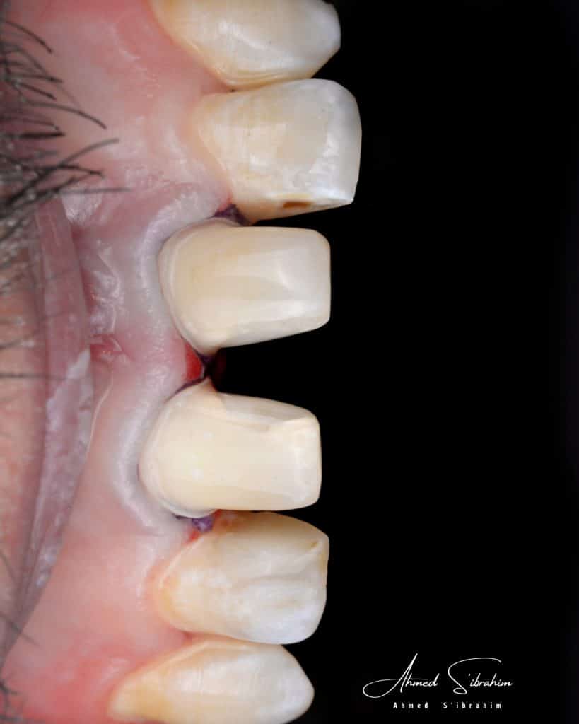 0BF7ECF5-36EC-4AC8-AE8A-1E043725AFD9