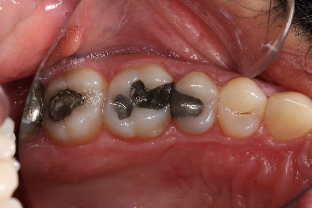 0D551D7C-088C-42A2-AFD8-CE4C3B2E4DE4