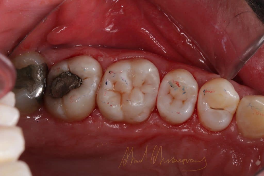 2015A722-BB0B-4413-B59C-C88EBC5EA4B6