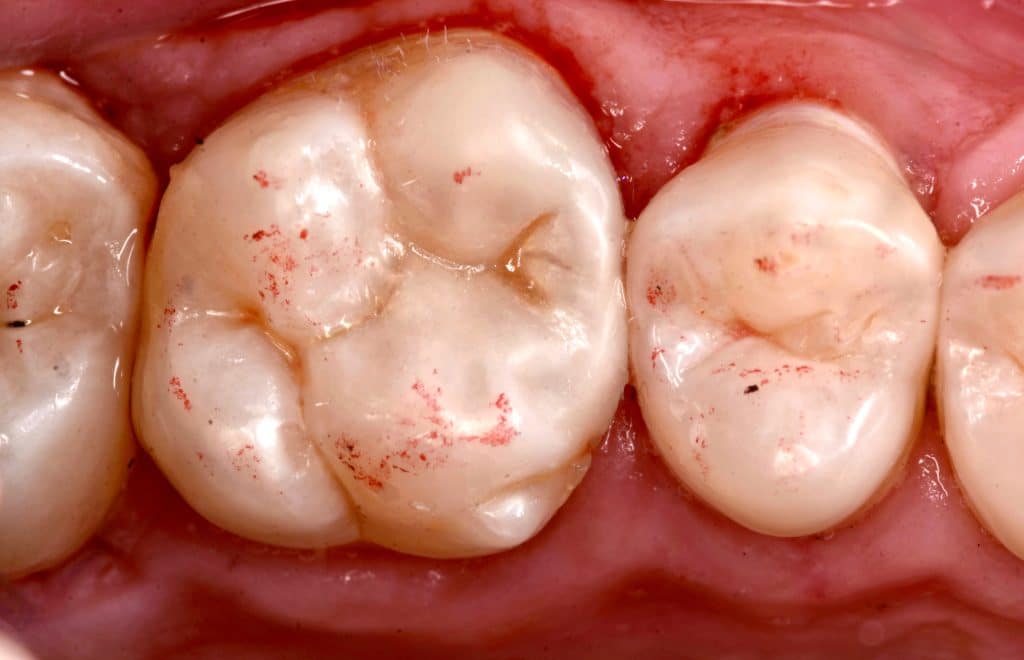 2E52A34D-AFC3-44B5-AFAE-4293B4E79532