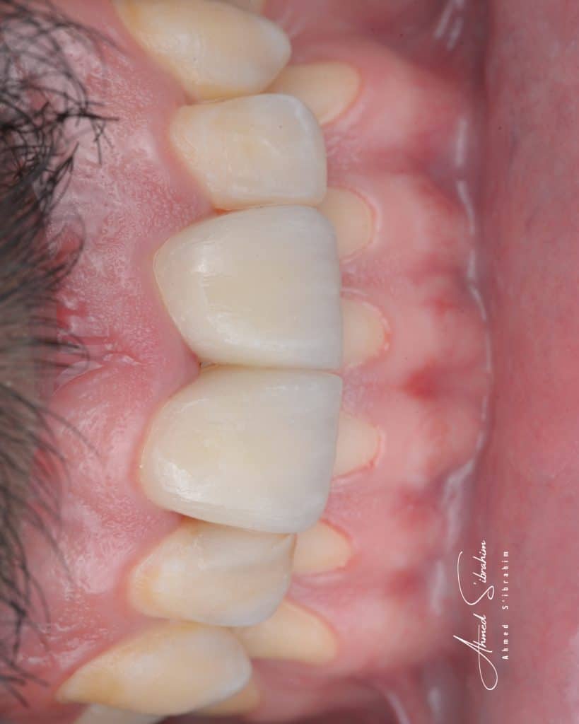 2F217D44-0BCC-48B4-B87E-01FBB7F48856