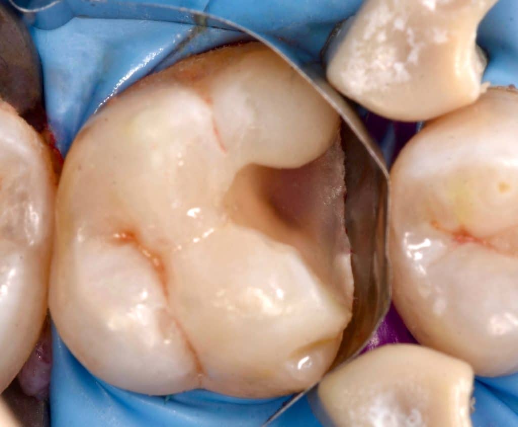 597E162F-5338-401D-8D18-FD6897AE4153