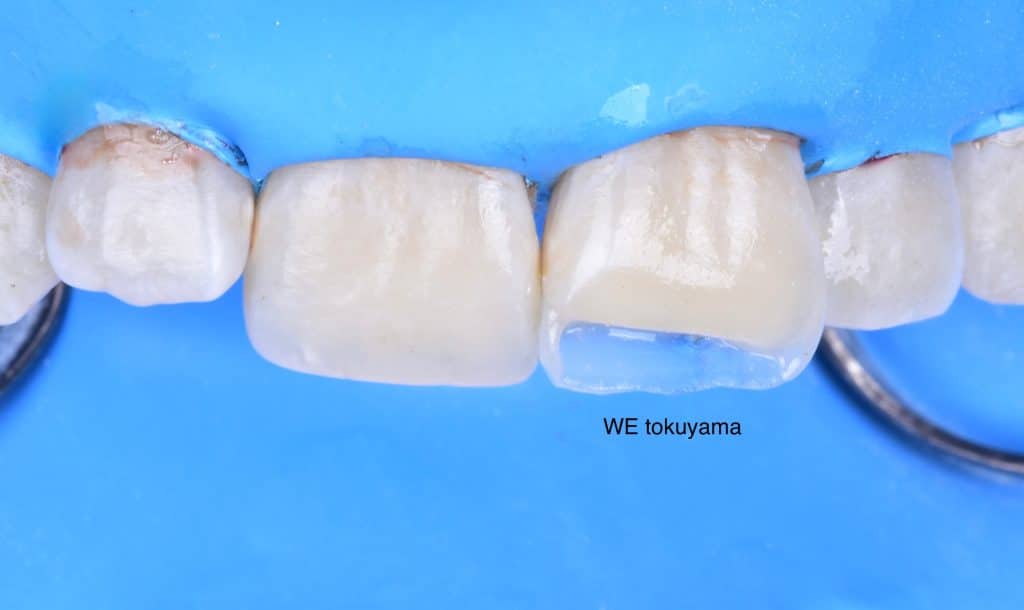 83FEF1CF-0B60-4120-94FA-F4E5011E4C91