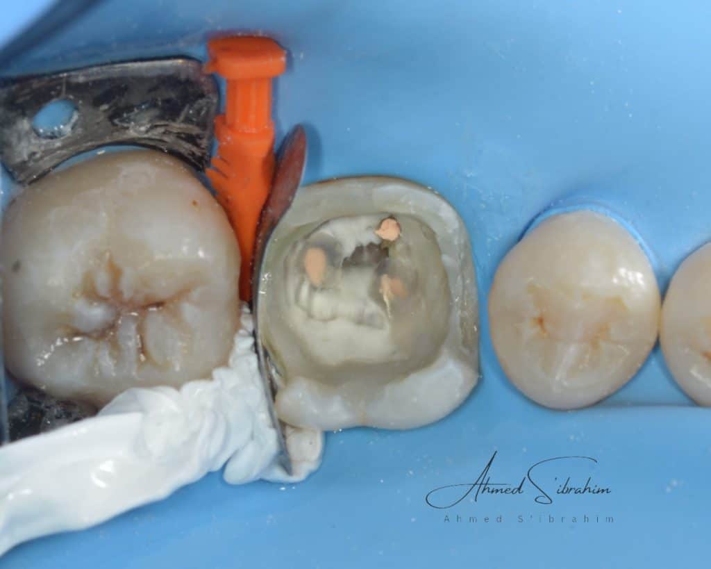 84257080-B81C-4AB7-A018-273D09CC8EC6