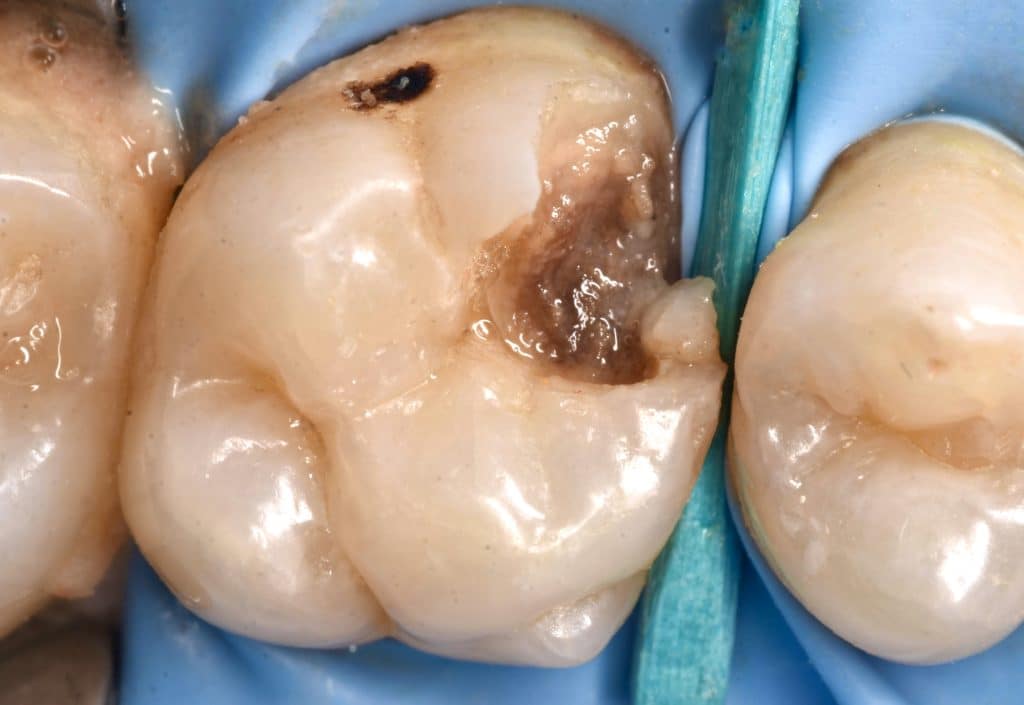 894A19F4-D649-4A81-B47D-ED718F1FD86B