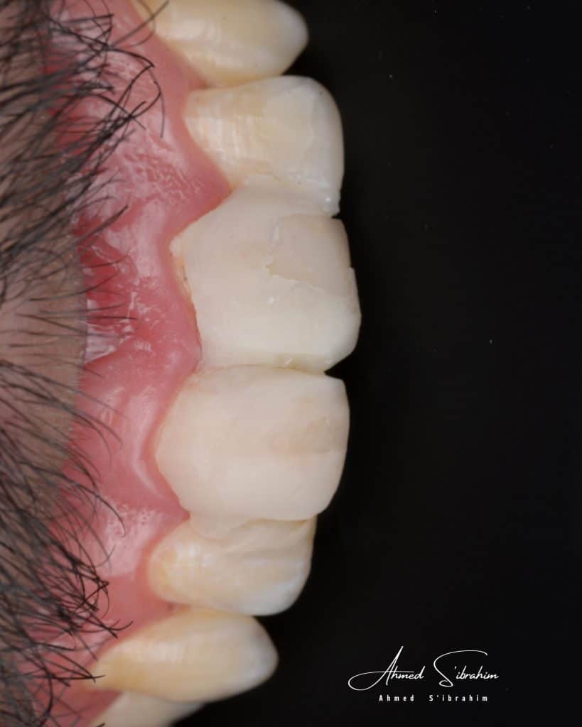 94E53573-7EC6-4E35-9DB8-0B1F156FA87D