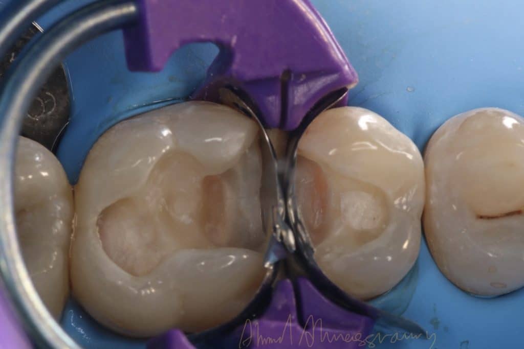 9B961115-0FF5-4321-9F2D-320FC9921D38