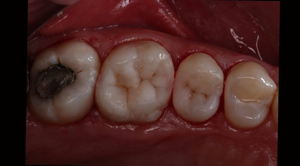 9C3765B9-BBCD-42E2-9C81-61C42AB0358E