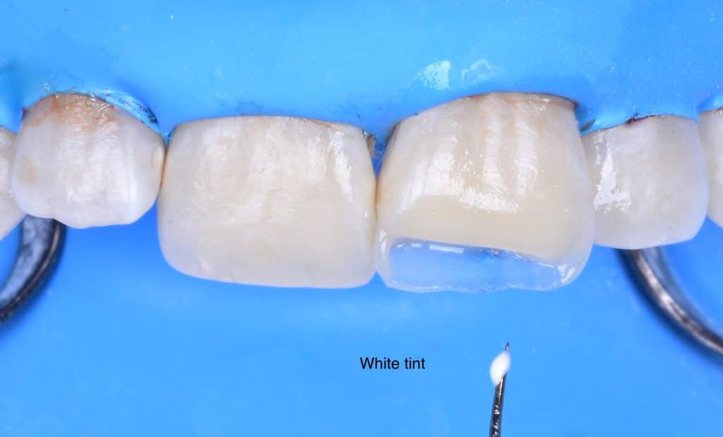 A5294FE6-AAE6-422F-9BDF-C28DEF2D7AD7