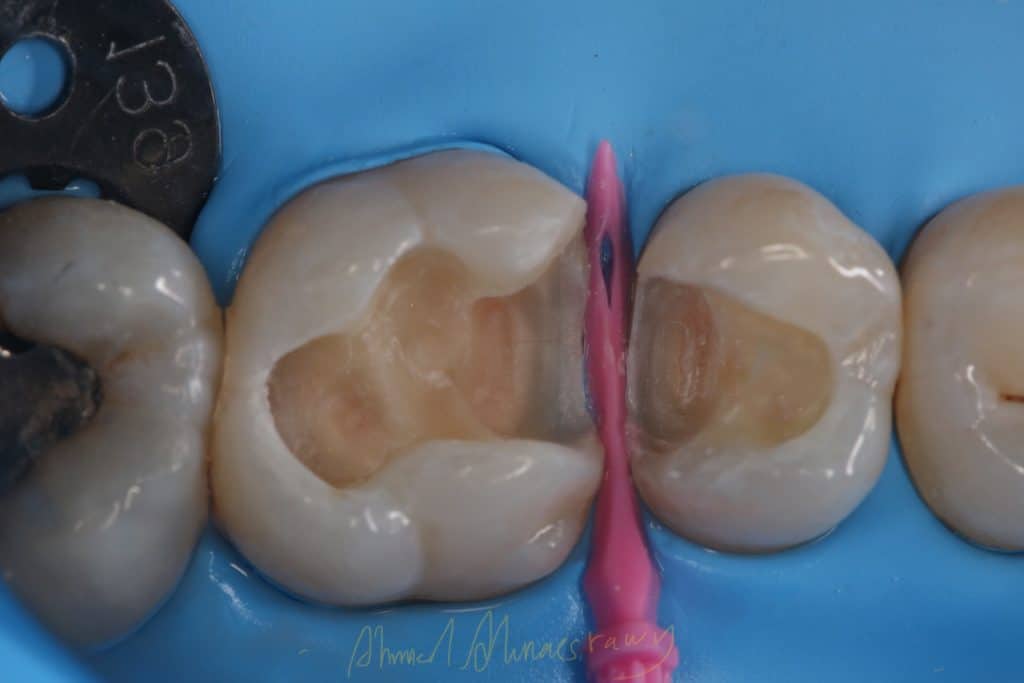 C94CDABF-8387-4AA6-B945-9E4EEAE2A7ED