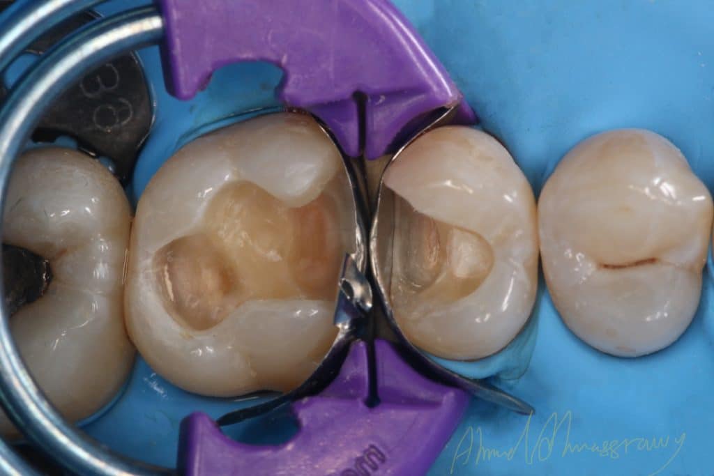 EE330B9E-4E11-4FC3-9D57-2DFEC429311F