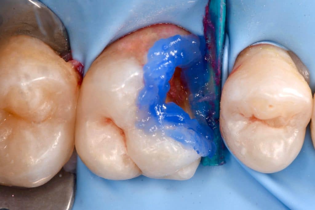 F745D8A8-608B-413A-B0F7-DB6991DDE956