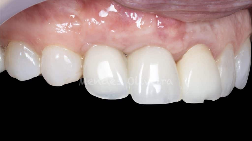 18 months follow-up 2