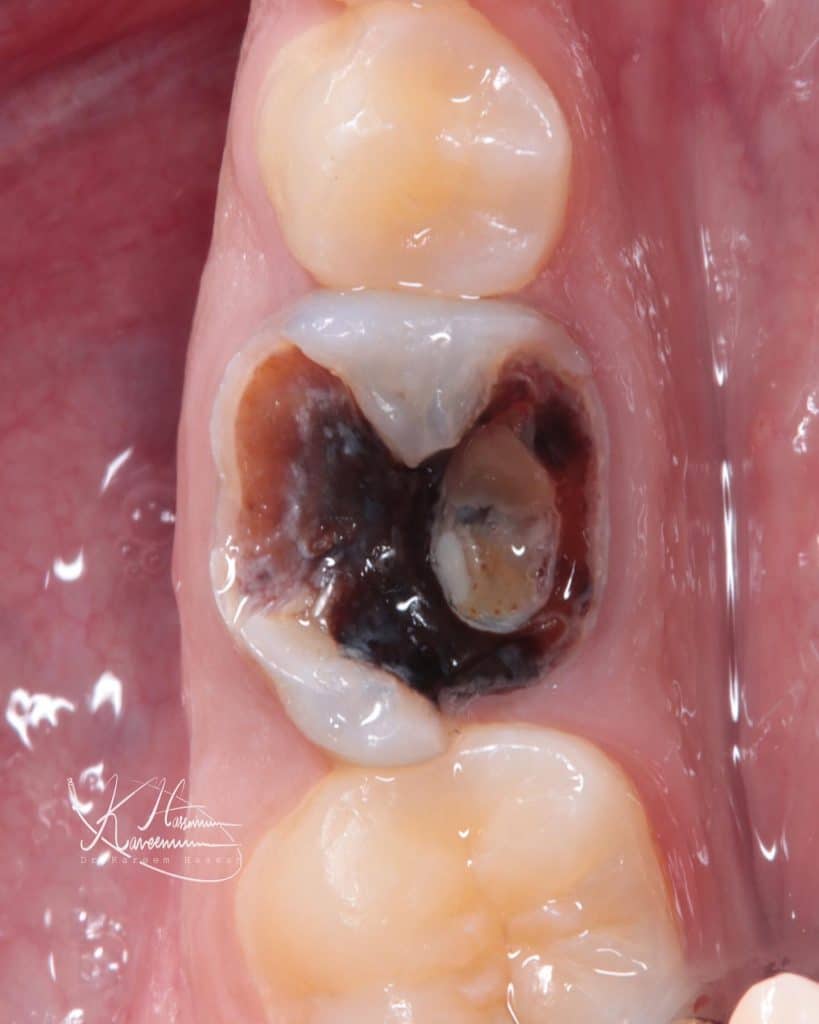 22B31421-04CA-42AC-9D6E-E68E08B95393