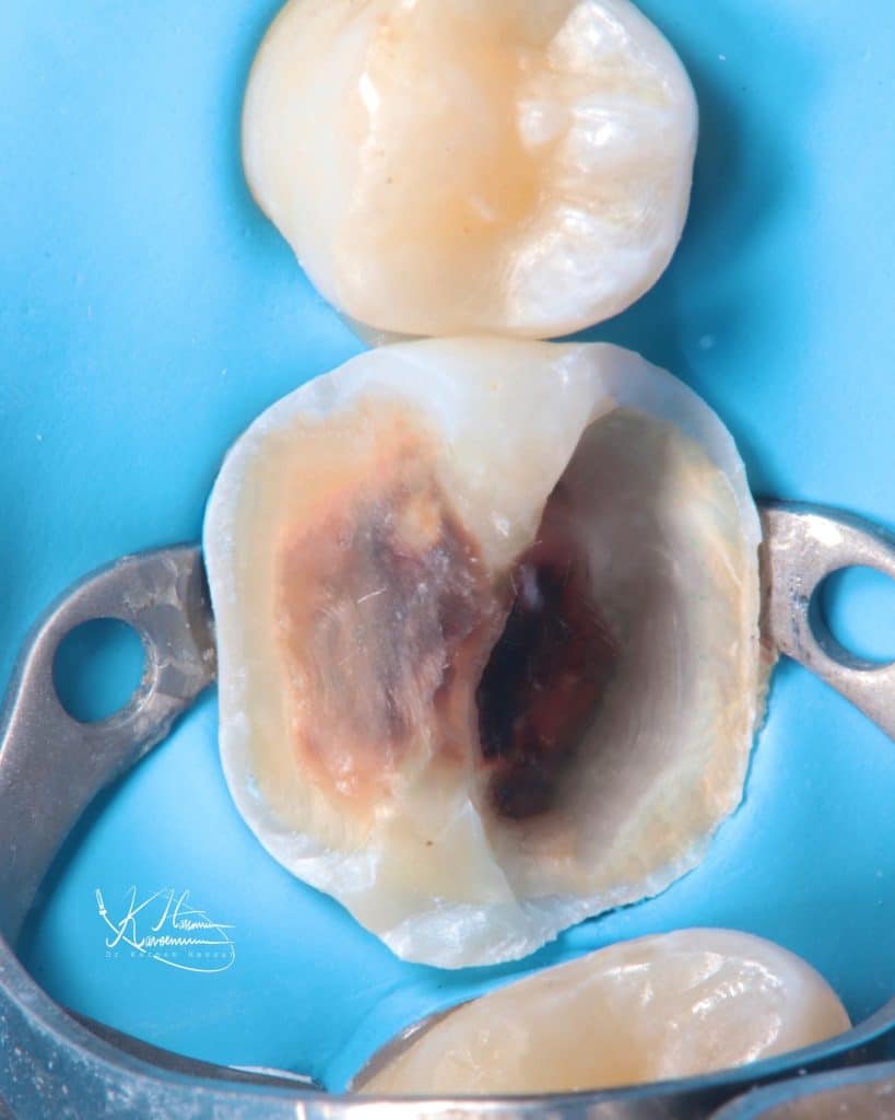 C6DE2BC5-A434-4D53-9001-8023234F37DA