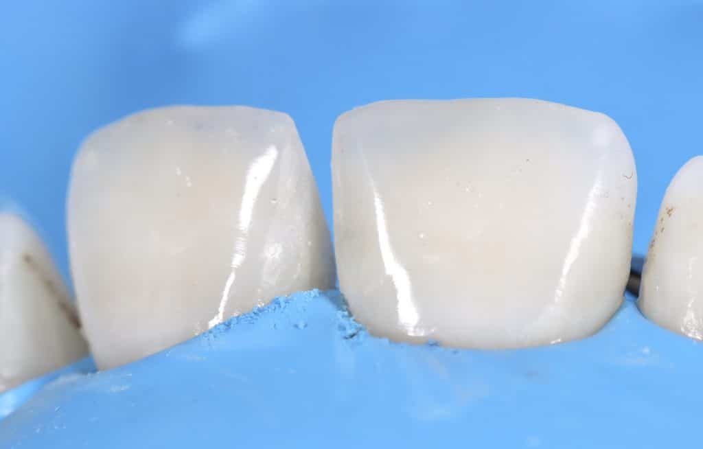 DEE31729-19CA-4865-BA6B-F72E612F8F45