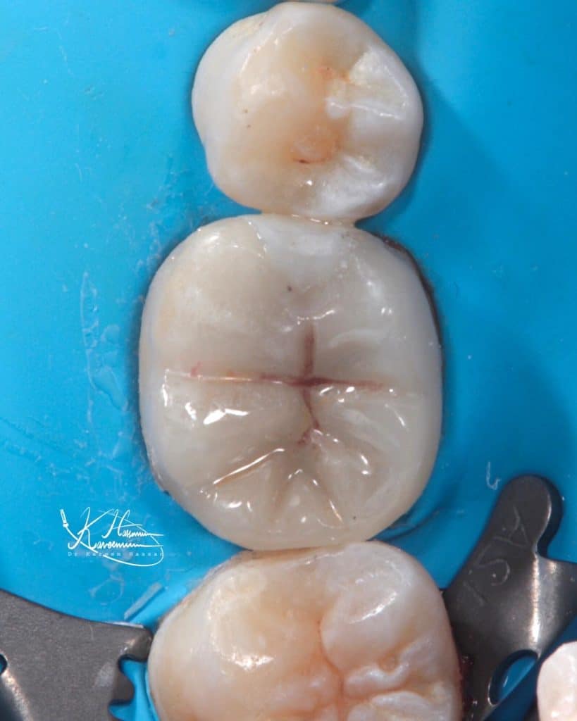 ED21FECB-5017-45B5-91CF-833DA8FBEF05