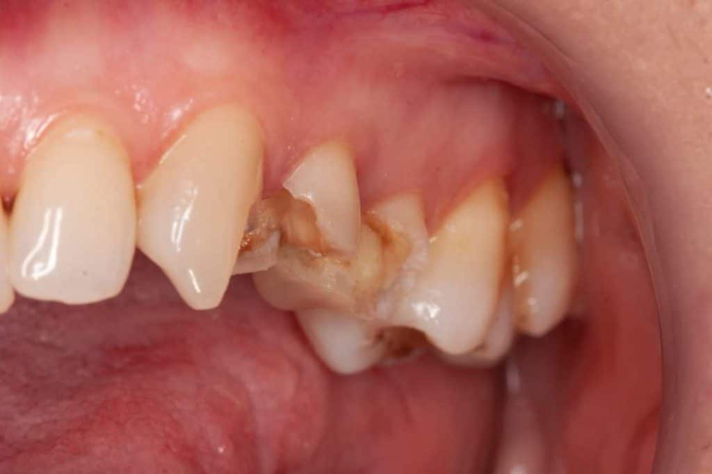 FB_IMG_1683827094774