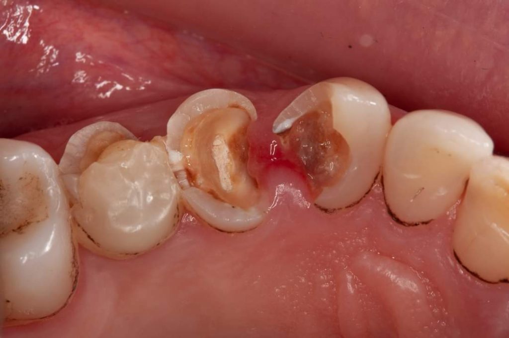 FB_IMG_1683827097536