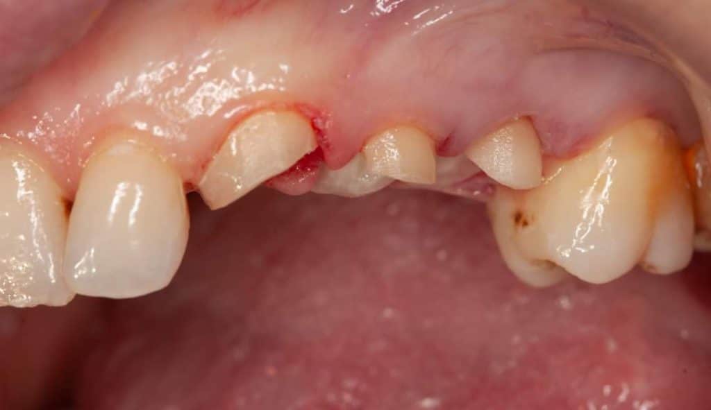 FB_IMG_1683827099849