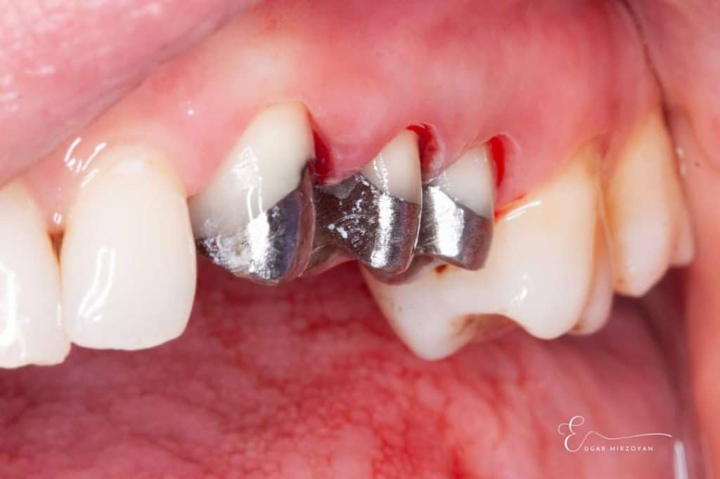 FB_IMG_1683827112282