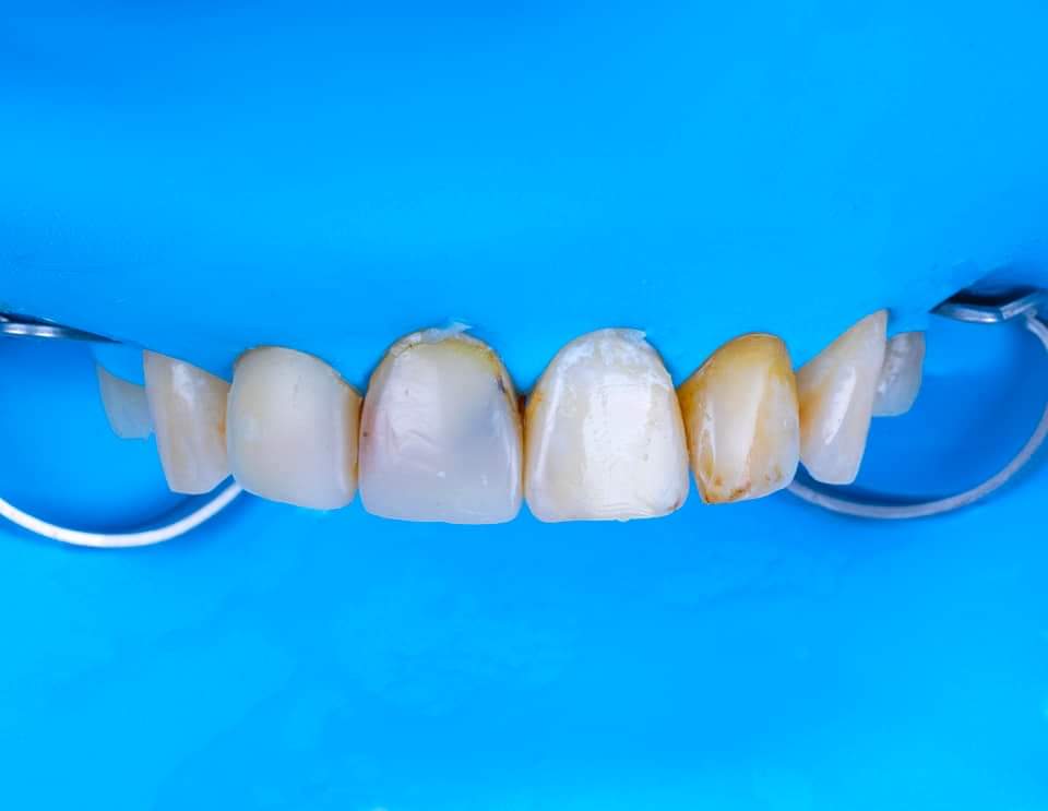 FB_IMG_1685353346220