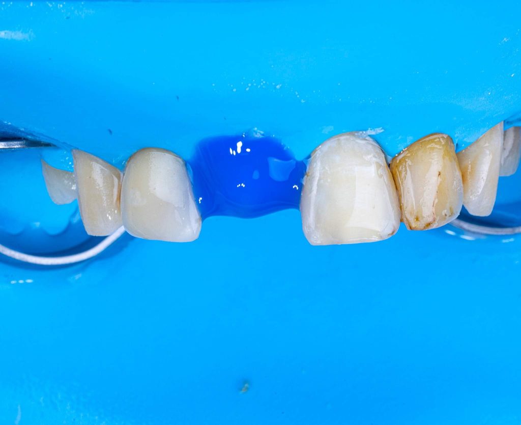 FB_IMG_1685353355124