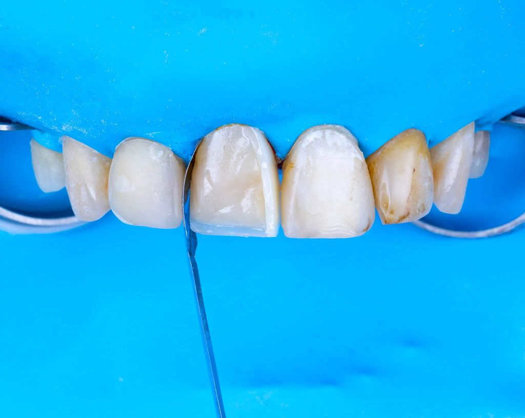 FB_IMG_1685353376332