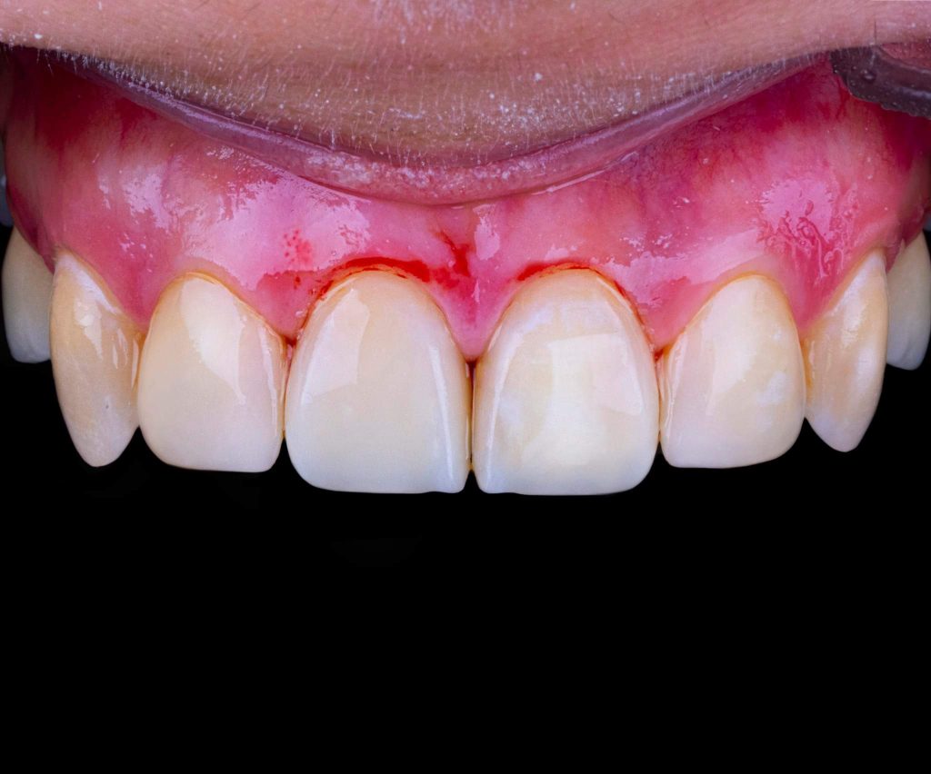 FB_IMG_1685353451120