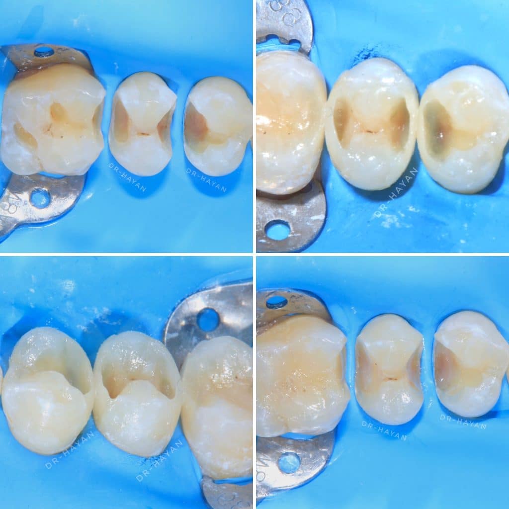 0B4A0074-09C6-45AD-A9FC-95A8D09CD3B0