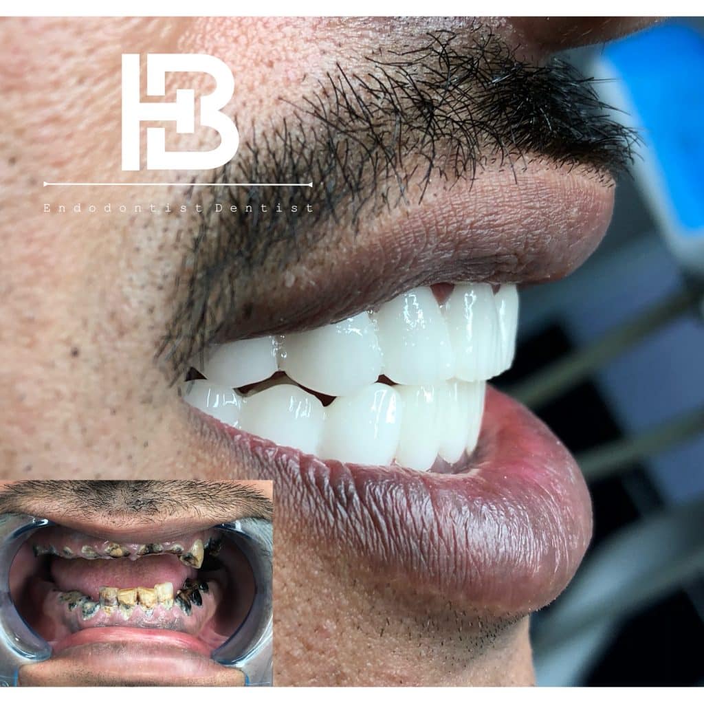 22EFF9BC-1B08-4E7D-B2FD-D8815913EE1A