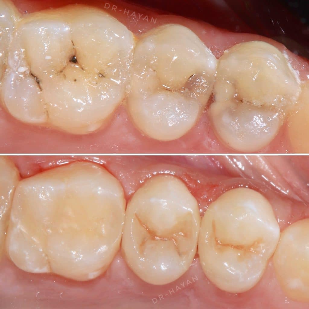 2ACBCB73-6188-4C8A-8D9F-EE28092D4A2B