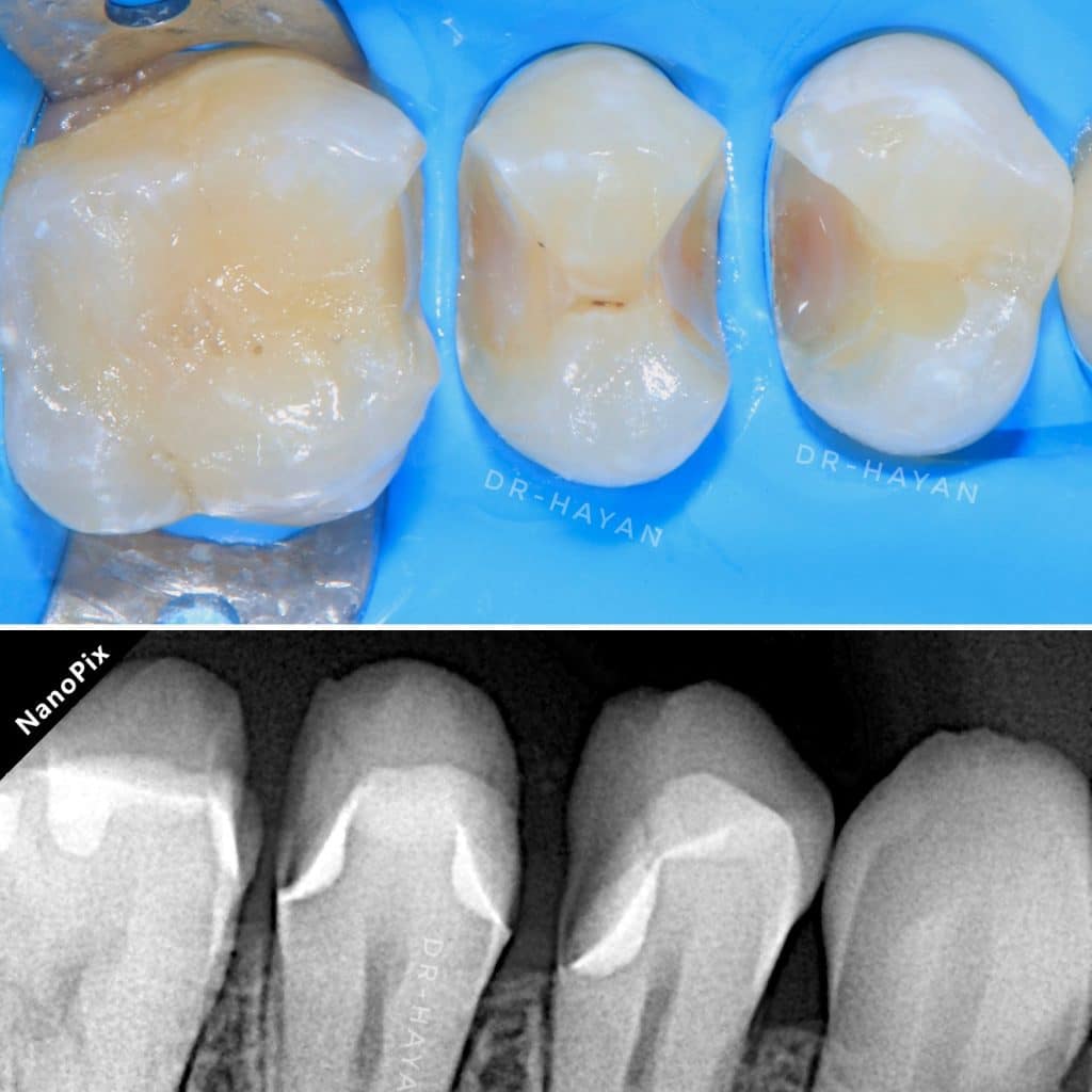 4B32A2A2-F7B3-48C8-BB85-69A0579F5F5C