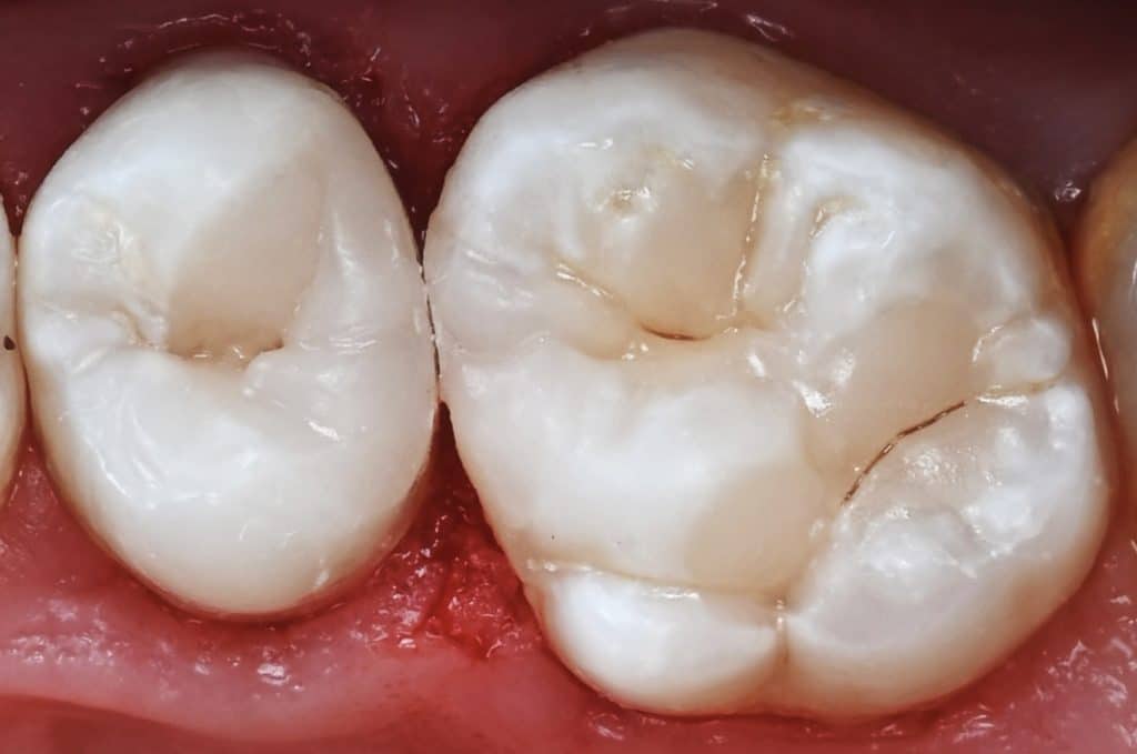 954ED6B0-D878-4B6C-956B-3D44DECC4253