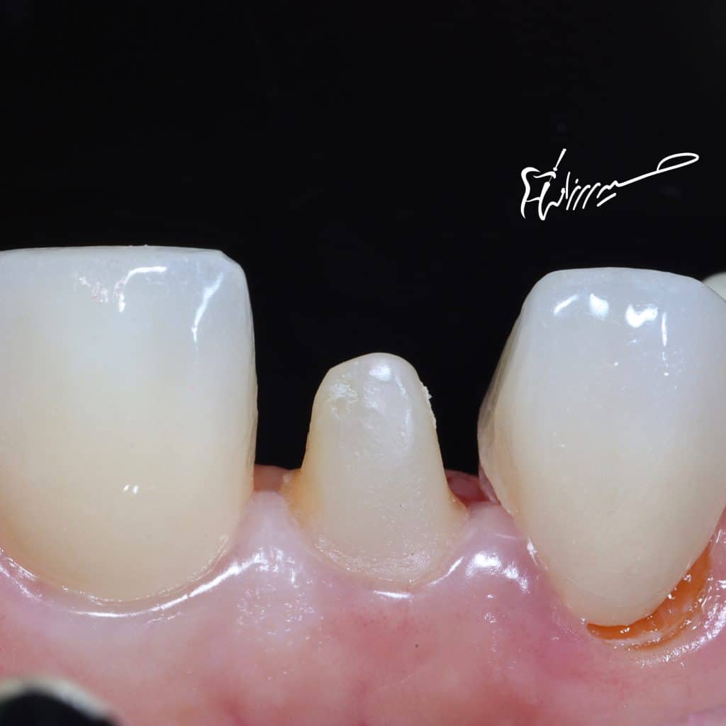 AA3F2E41-07D3-48C7-92BD-459C9135D31E