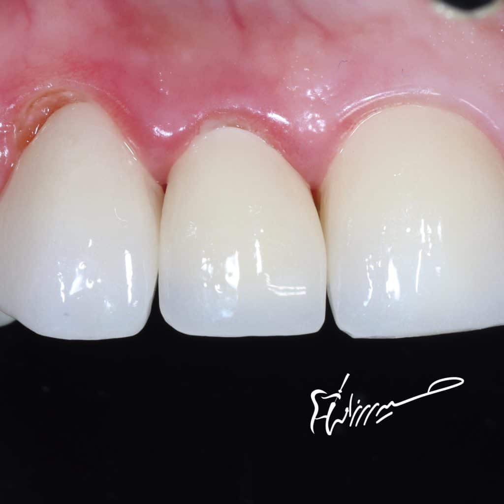 D50A6AA0-80FD-45B9-93B2-8DCA0FA14EAF