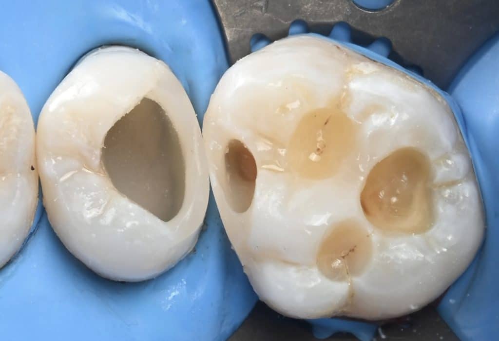 EA0B4675-31D2-4F3C-A5F2-47F35C470325