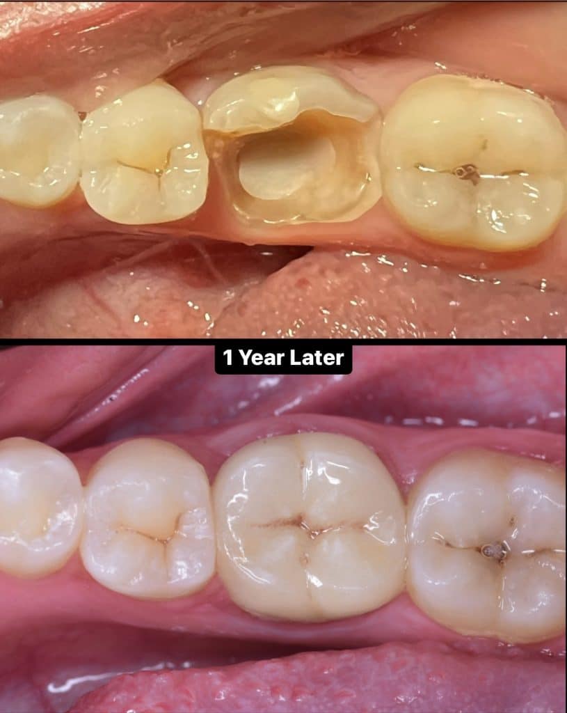 00BF7F07-9600-449B-B098-E0BD1573BBF0