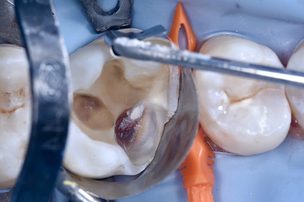 272A286F-DE4D-4163-9521-9829C6545AF8