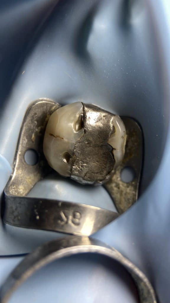 75EE7BA7-1A3B-41FF-99F5-B3886989348B