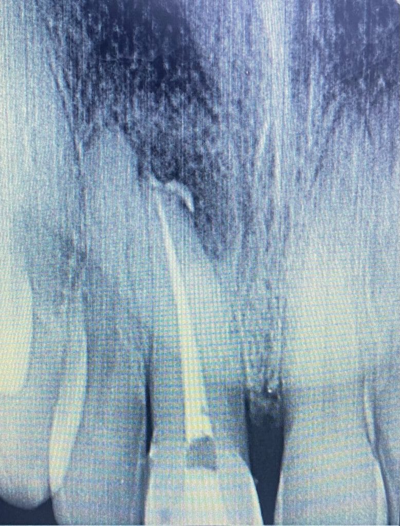 A013AA39-577B-4AC5-8653-750B0A363654