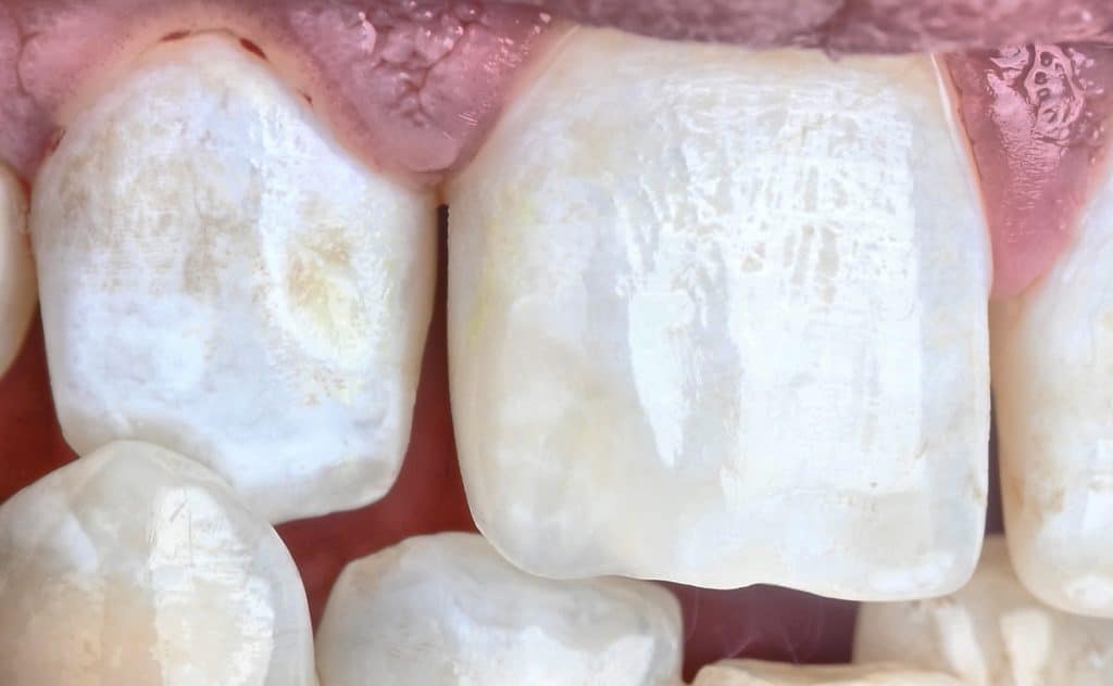 A5AB01F6-7D93-4147-927D-608C8F5C62A6