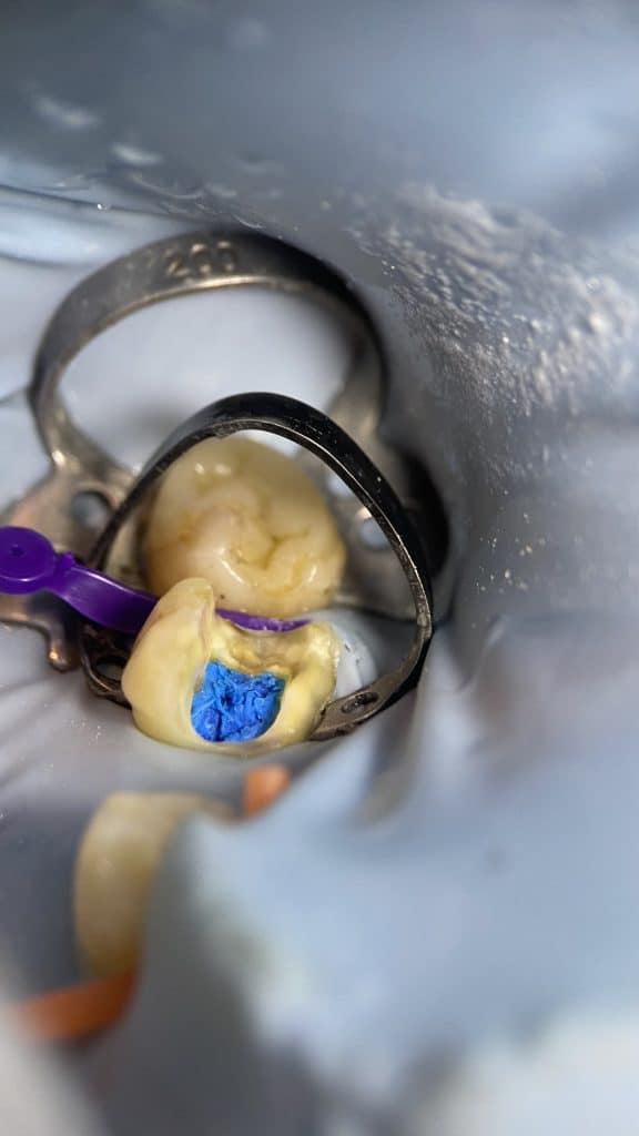 D1EB5760-A2A0-4DD8-99D6-C83A4BBA01DE