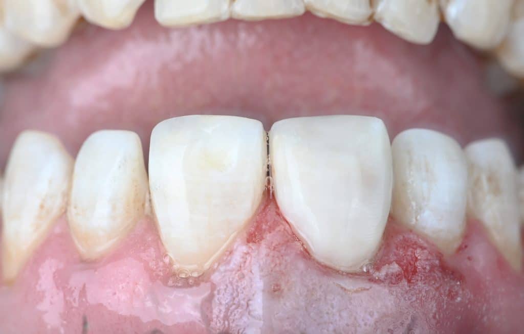 D60D816D-7D1D-45F6-8DE6-A6A2C7F0C03A