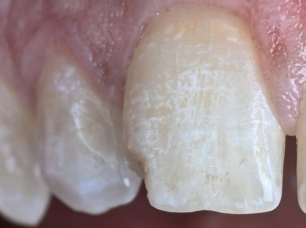 EBD1B844-FB6F-41E1-84E8-0E4EDE22F59A