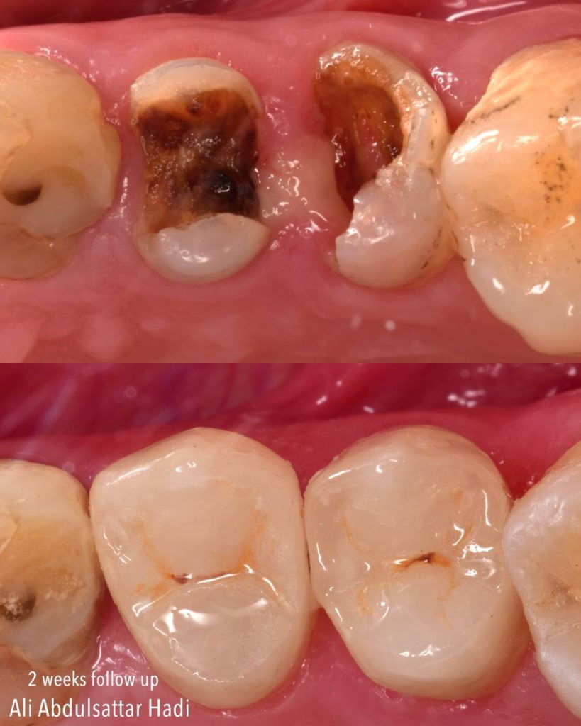 IMG_20230704_225830_495