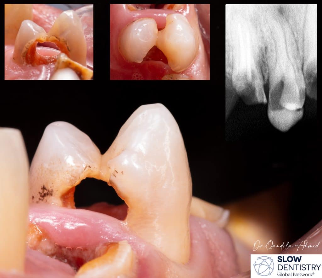 All Sides All Corners Situation .