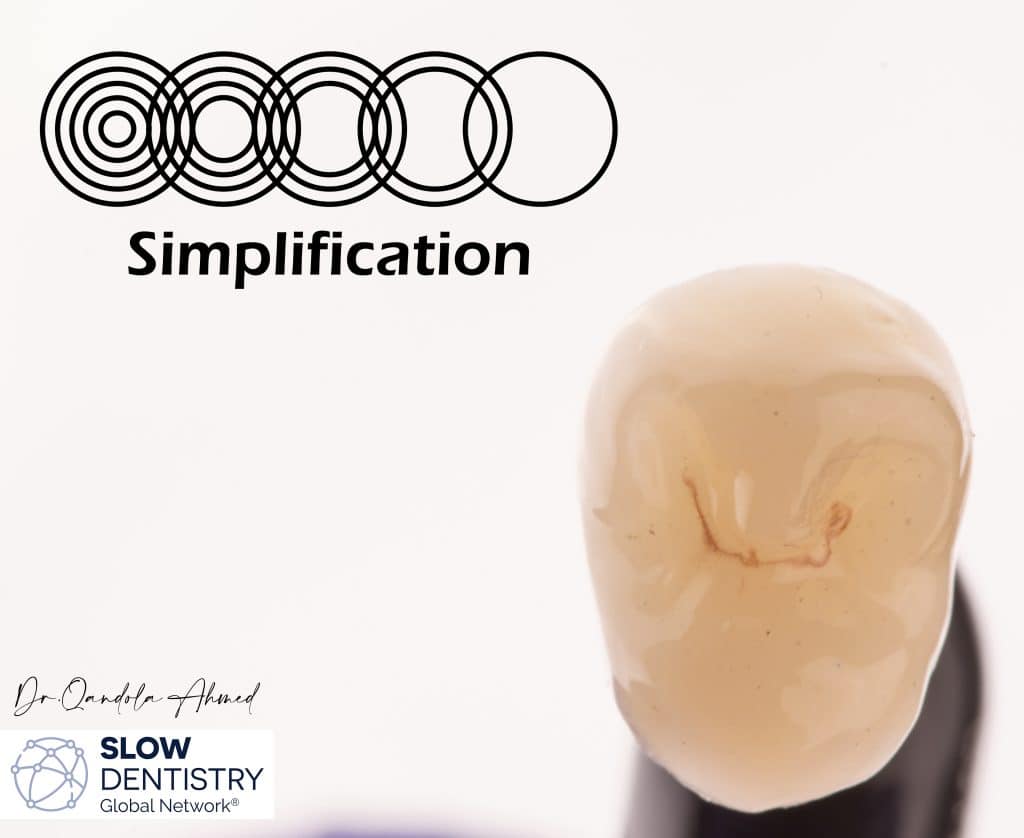 Lithium disilicate overlay .